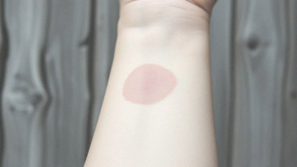 Twardzina skóry objawy – jak rozpoznać twardzinę ograniczoną?